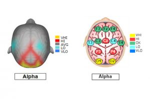 View of brain charts